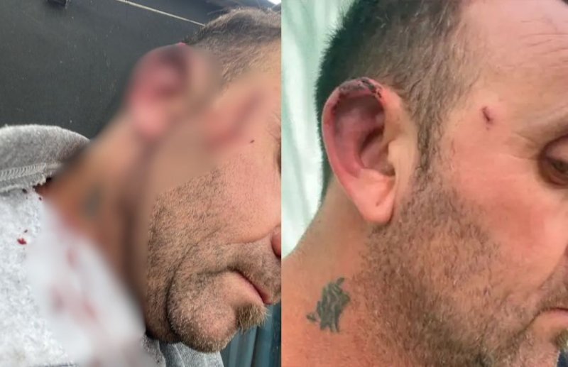El Intendente de Pueblo Brugo resultó herido tras una pelea con un concejal