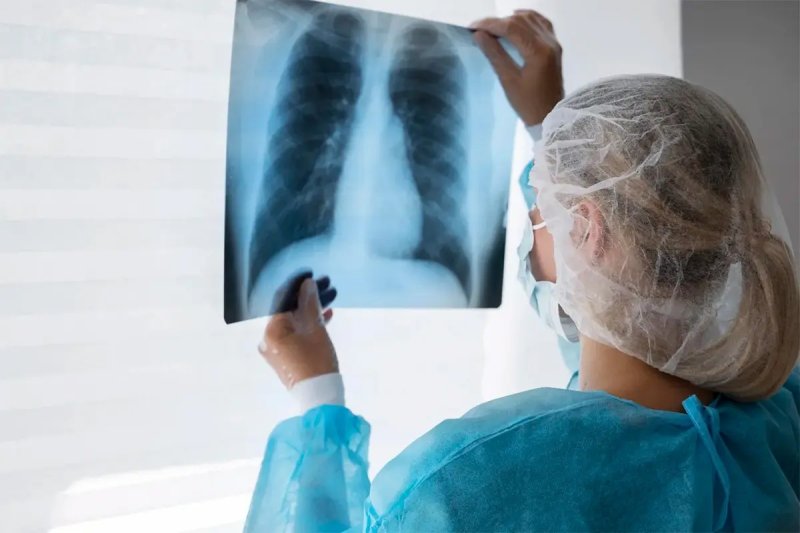 Entre Ríos registró un aumento de casi 39% en casos de tuberculosis